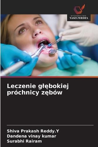 Leczenie glębokiej próchnicy zębów