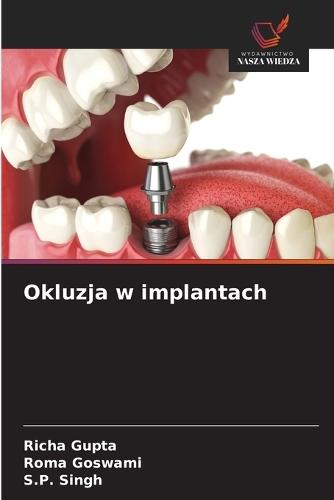 Okluzja w implantach