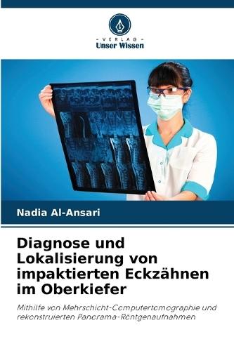 Diagnose und Lokalisierung von impaktierten Eckzähnen im Oberkiefer