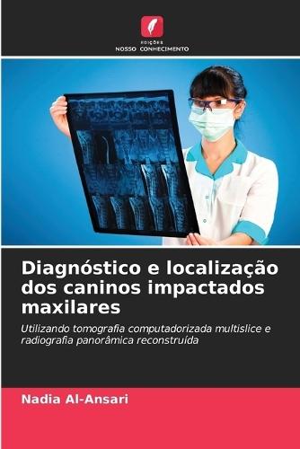 Diagnóstico e localização dos caninos impactados maxilares