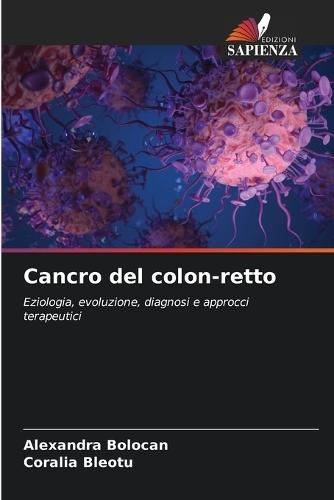 Cancro del colon-retto