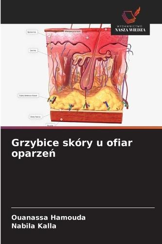 Grzybice skóry u ofiar oparzeń