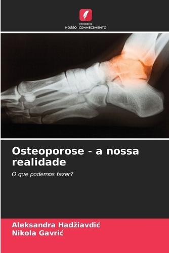 Osteoporose - a nossa realidade