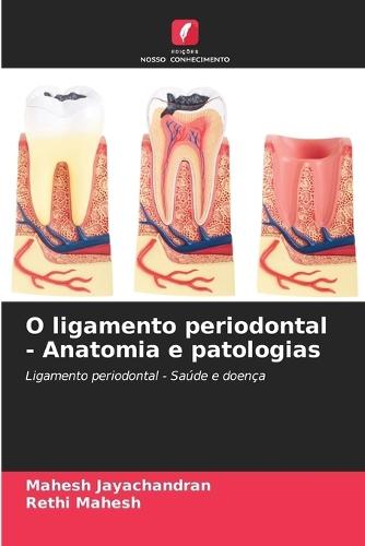 O ligamento periodontal - Anatomia e patologias