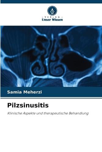 Pilzsinusitis
