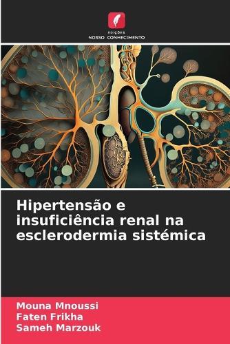 Hipertensão e insuficiência renal na esclerodermia sistémica