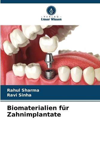 Biomaterialien für Zahnimplantate