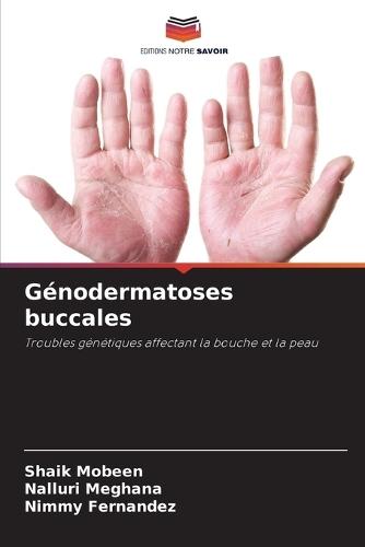 Génodermatoses buccales