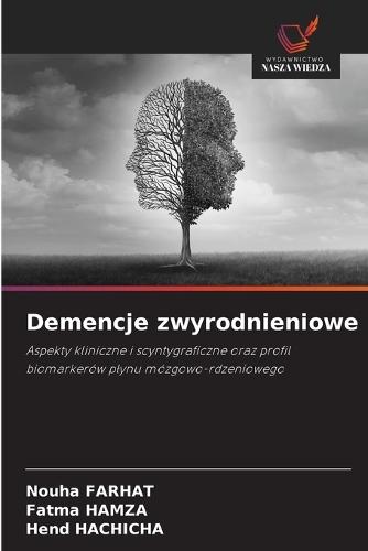 Demencje zwyrodnieniowe