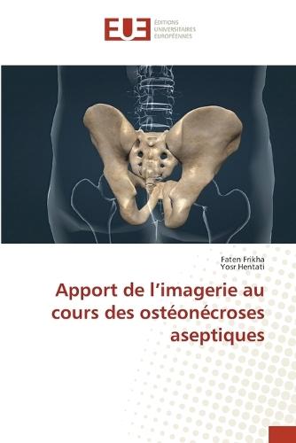 Apport de l'imagerie au cours des ostéonécroses aseptiques