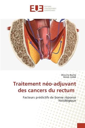 Traitement néo-adjuvant des cancers du rectum