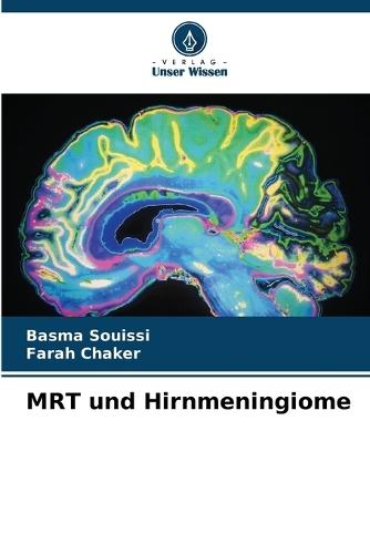 MRT und Hirnmeningiome