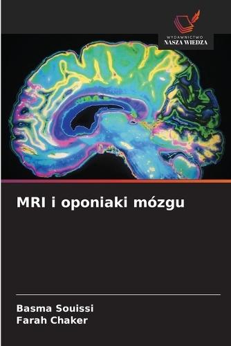 MRI i oponiaki mózgu
