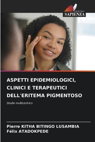 Aspetti Epidemiologici, Clinici E Terapeutici Dell'eritema Pigmentoso