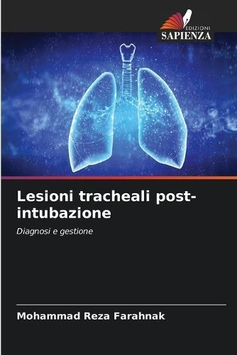 Lesioni tracheali post-intubazione