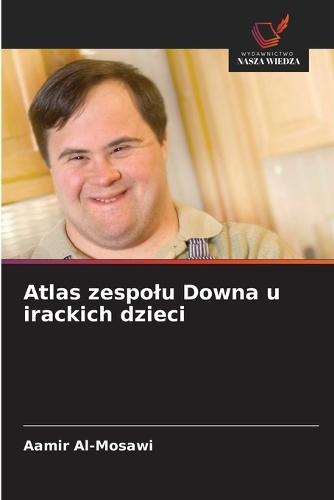 Atlas zespolu Downa u irackich dzieci