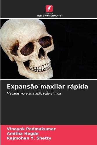 Expansão maxilar rápida