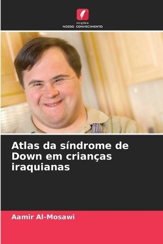 Atlas da síndrome de Down em crianças iraquianas