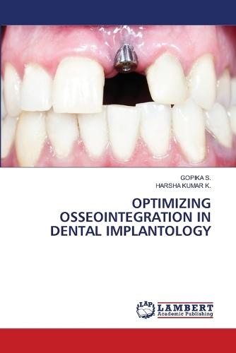 Optimizing Osseointegration in Dental Implantology