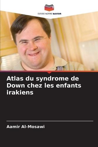 Atlas du syndrome de Down chez les enfants irakiens