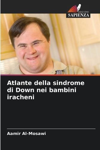 Atlante della sindrome di Down nei bambini iracheni