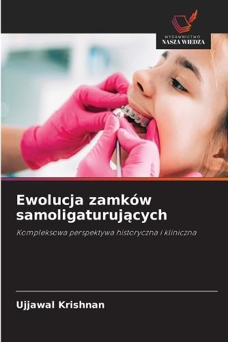 Ewolucja zamków samoligaturujących