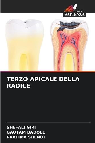 Terzo Apicale Della Radice