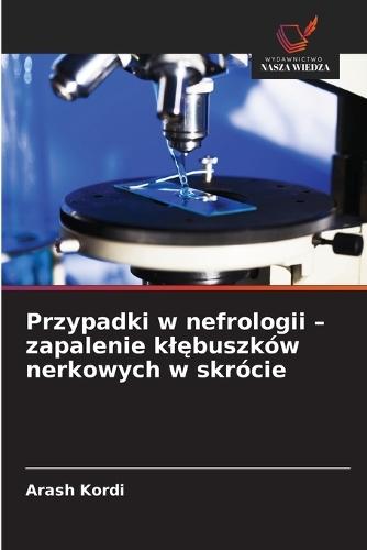 Przypadki w nefrologii - zapalenie klębuszków nerkowych w skrócie