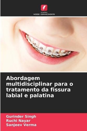 Abordagem multidisciplinar para o tratamento da fissura labial e palatina