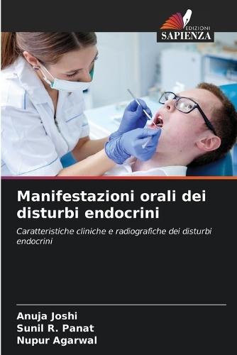 Manifestazioni orali dei disturbi endocrini