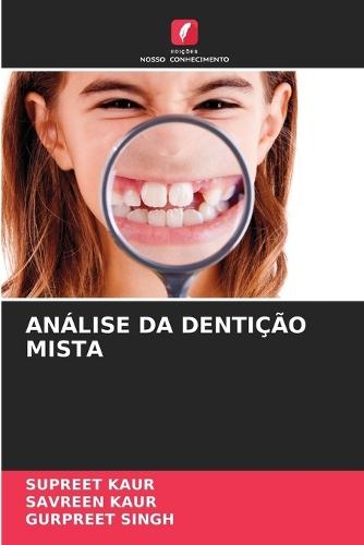 Análise Da Dentição Mista
