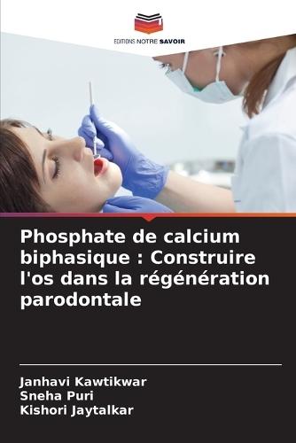 Phosphate de calcium biphasique: Construire l'os dans la régénération parodontale