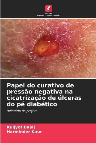 Papel do curativo de pressão negativa na cicatrização de úlceras do pé diabético