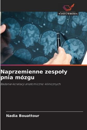Naprzemienne zespoly pnia mózgu
