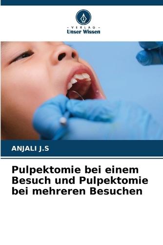 Pulpektomie bei einem Besuch und Pulpektomie bei mehreren Besuchen