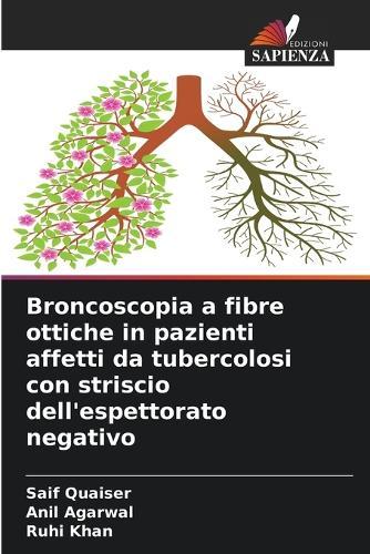 Broncoscopia a fibre ottiche in pazienti affetti da tubercolosi con striscio dell'espettorato negativo