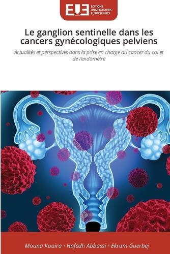 Le ganglion sentinelle dans les cancers gynécologiques pelviens