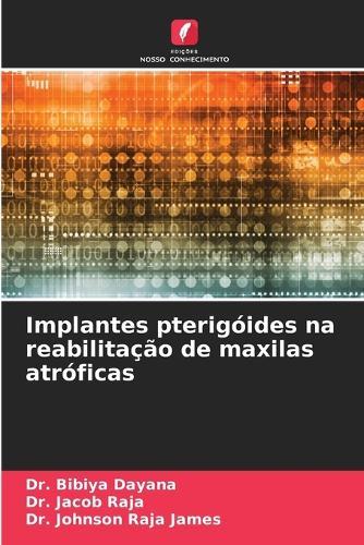 Implantes pterigóides na reabilitação de maxilas atróficas