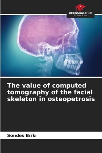 The value of computed tomography of the facial skeleton in osteopetrosis