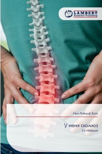 У меня сколиоз