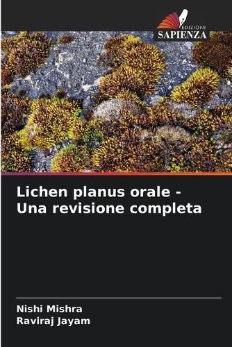 Lichen planus orale - Una revisione completa
