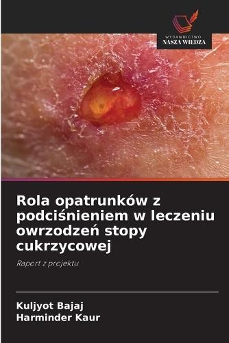 Rola opatrunków z podci&#347;nieniem w leczeniu owrzodze&#324; stopy cukrzycowej