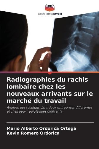 Radiographies du rachis lombaire chez les nouveaux arrivants sur le marché du travail