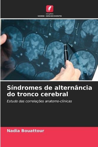 Síndromes de alternância do tronco cerebral
