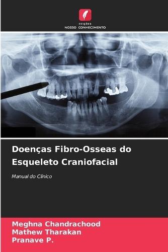 Doenças Fibro-Osseas do Esqueleto Craniofacial