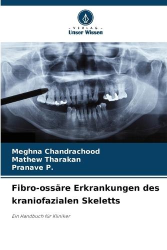 Fibro-ossäre Erkrankungen des kraniofazialen Skeletts