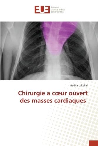 Chirurgie a coeur ouvert des masses cardiaques