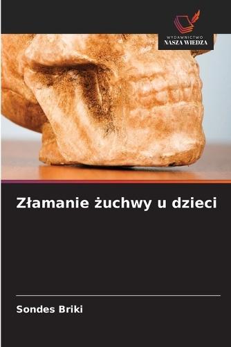 Zlamanie żuchwy u dzieci