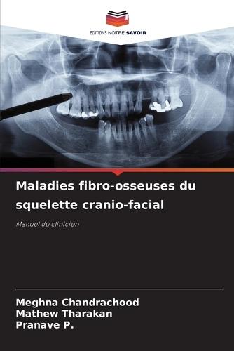Maladies fibro-osseuses du squelette cranio-facial