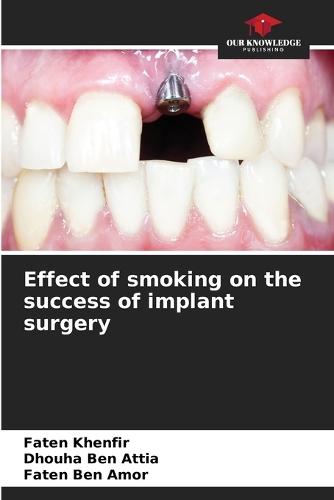 Effect of smoking on the success of implant surgery